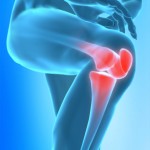 IStock 000011393494XSmall-150x150 in Gonarthrose - Was ist das? Was kann ich tun? 