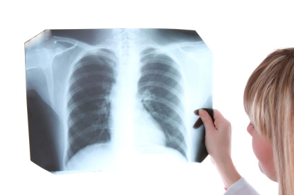 Lunge Röntgenbild
